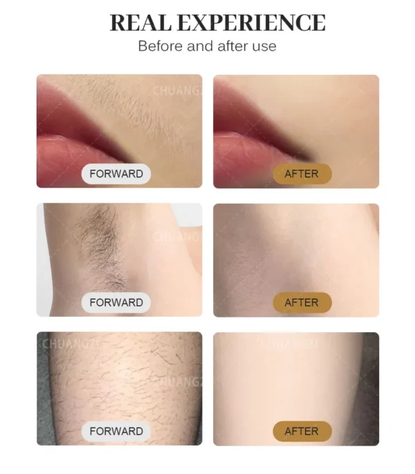 3000W High Power Ice Cooling 755 808 1064 Device Diode Laser Epilator Wavelength Painless 808nm Hair Removal Machine - Image 17